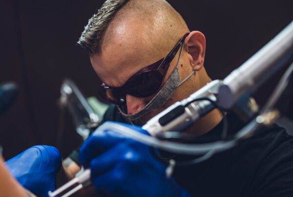 Laserowe usuwanie tatuażu Speak In Color