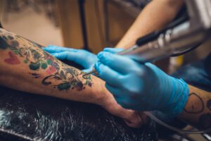 10 faktów i mitów o laserowym usuwaniu tatuażu